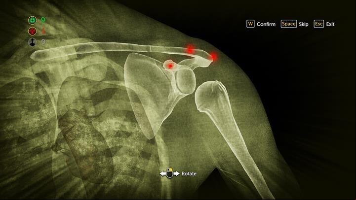 Set the shoulder of the man - move the bone when the points will be lightly highlighted - Helping the victims of the accident | Walkthrough - Chain Reaction | Walkthrough - Sherlock Holmes: The Devils Daughter Game Walkthrough