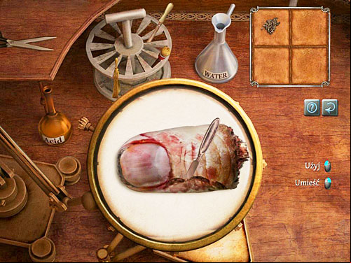 Finally, using the scalpel (the one from stand) examine the finger in the bitten place and where the bone is visible - Check the Collected Evidences | The Murder in Diocese of Knightsbridge - The Murder in Diocese of Knightsbridge - The Testament of Sherlock Holmes Game Guide