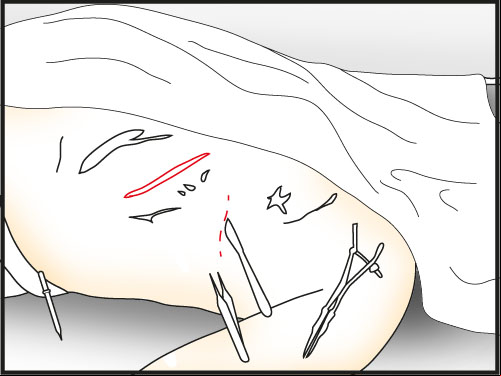 make two cuts with scalpel in marked places - Make a Dissection | Slaughter in Whitechapel - Slaughter in Whitechapel - The Testament of Sherlock Holmes Game Guide