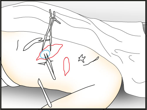use tweezers on stomach to pull out some paper (Kurtz Map goes to Documents) - Make a Dissection | Slaughter in Whitechapel - Slaughter in Whitechapel - The Testament of Sherlock Holmes Game Guide